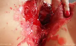 Analno zlostavljanje porno hub films